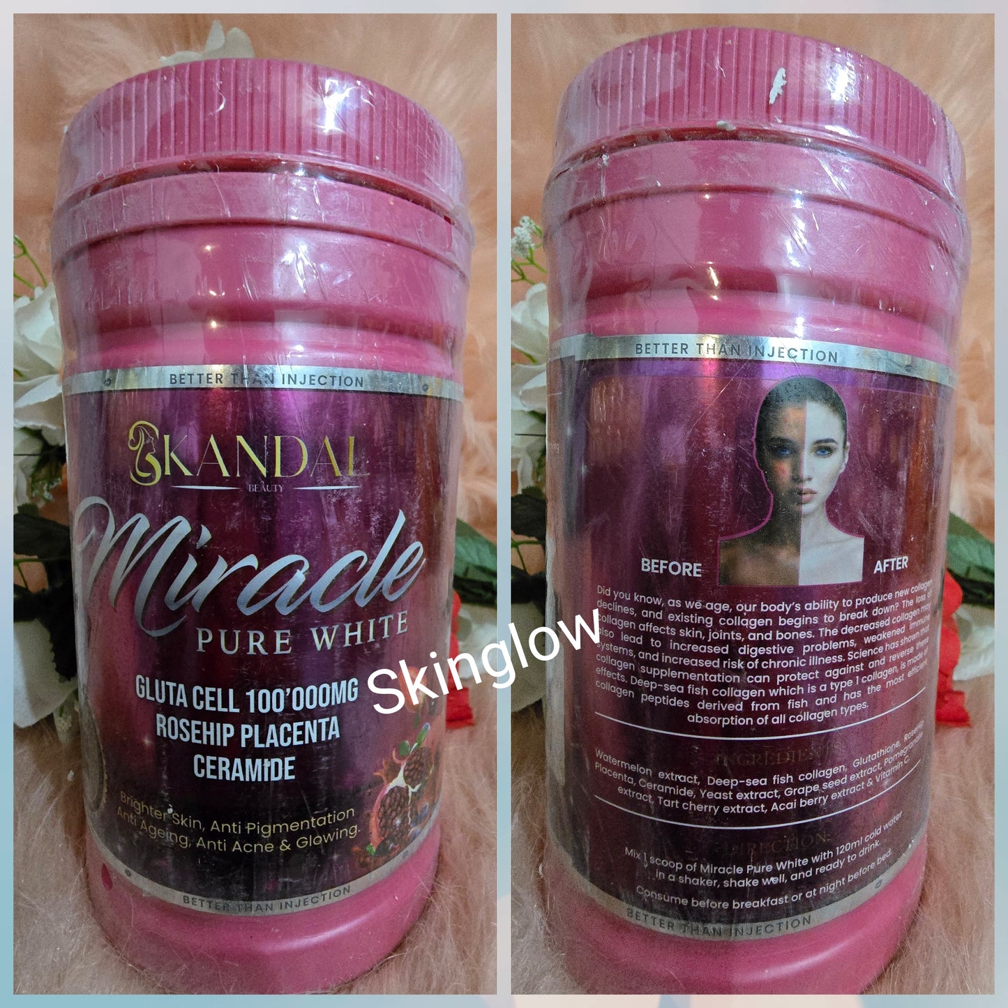 💯 Authentic  Skandal Miracle Purewhite premium edition 800g jar x1 anti-aging